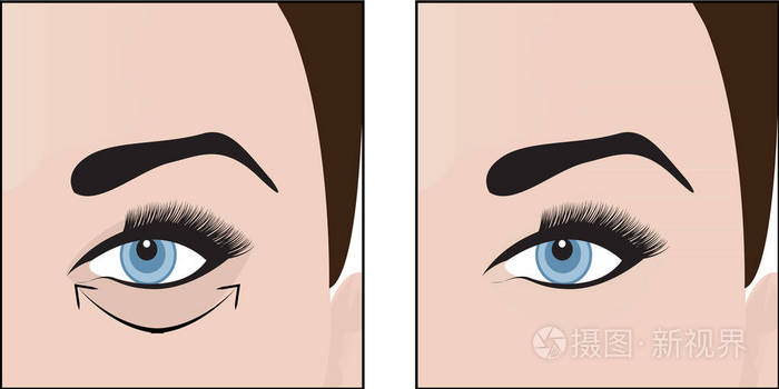 黑眼圈的眼睛删除插画-正版商用图片0zyxlz-摄图新视界