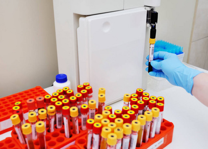 电解质紊乱图片-电解质紊乱素材-电解质紊乱插画-摄图新视界