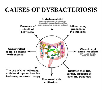 肠道 dysbiosis 的原因。结肠.细菌致病菌群。信息.孤立背景下的矢量图示
