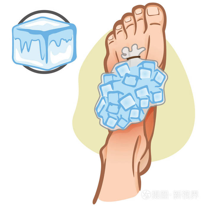 图冷杉援助人高加索, 脚与冰袋子, 顶面看法.