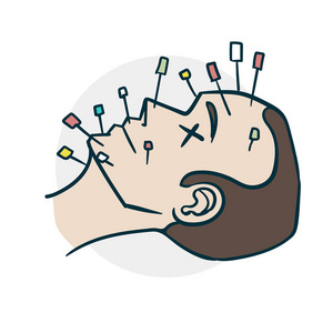 针刺手法对面部漫画风格的影响照片