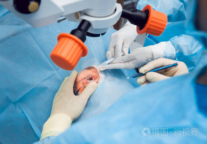 对高级女性的眼睛做手术.白内障手术.医疗设备.