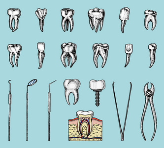 磨牙牙釉质, 牙科组。牙科医生的仪器设备。口腔清洁或生病。健康或龋齿的人。刻在旧的或素描手绘的手。药物, 治疗腔, 植入物