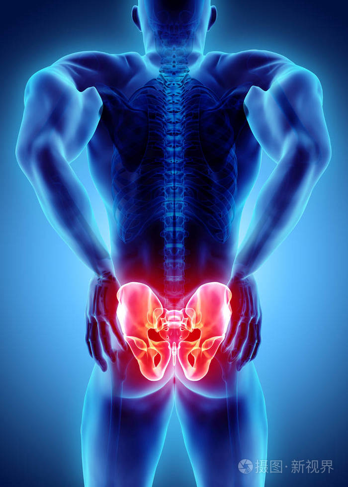 髋关节痛骨骼 x 射线,3d 图