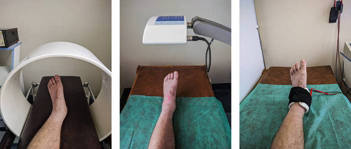 物理疗法一套模范脚踝规程图片