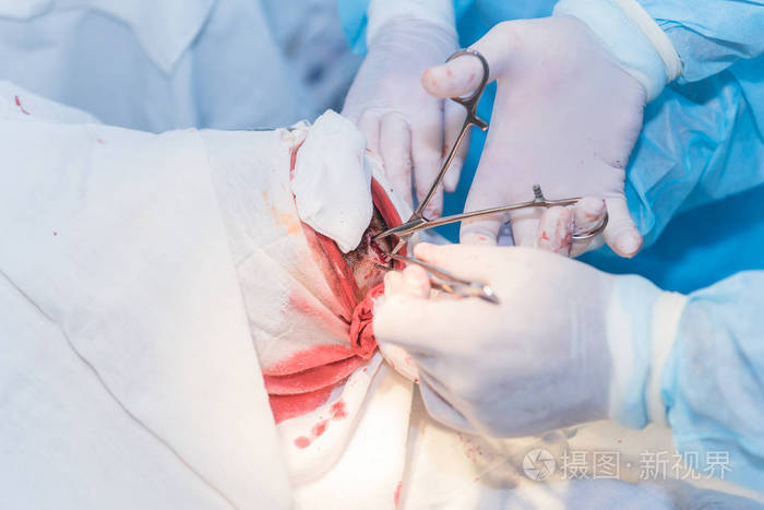 外科医生的手缝合皮肤的切口 af