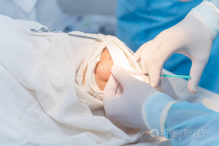 麻醉用注射器的手, 麻醉的 p