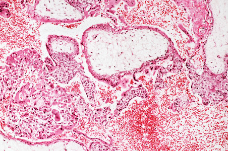 高倍镜下滋养层细胞显微观察照片