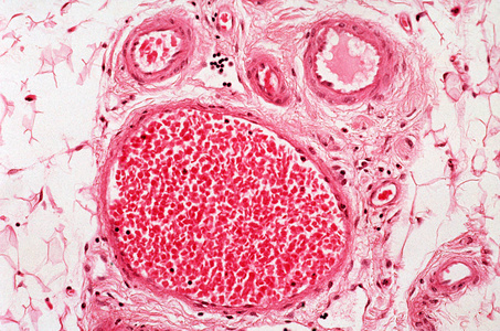 在高倍镜下观察血管照片