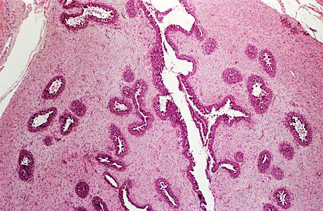在高倍镜下观察乳腺组织照片