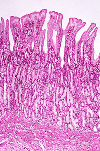 黏膜高倍镜下淋巴黏膜观察照片