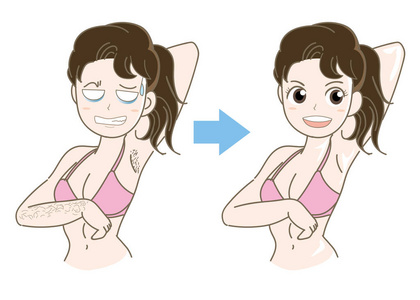 女性脱毛图像-前后照片