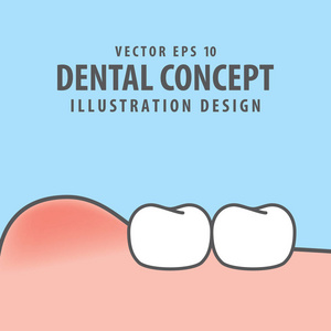 在蓝色背景上用牙齿图示向量肿胀牙龈