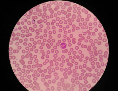 血红细胞医学背景照片