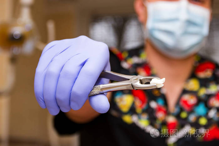 金属钳中的拔牙