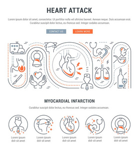 心脏病发作的线图。 网页横幅和印刷材料的概念。 带有网站横幅和登陆页面按钮的模板。