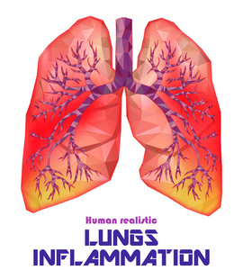 病态人的现实肺和气管在低聚。胸膜炎, 一个