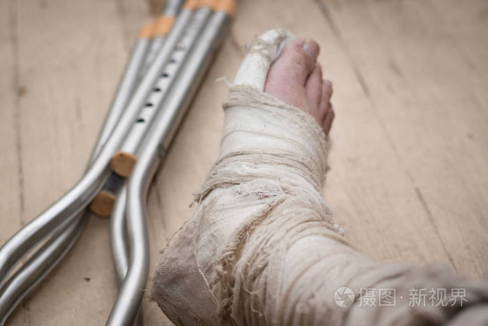 破烂的木地板上的石膏腿断了