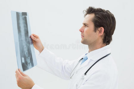 男医生集中检查脊柱x光片