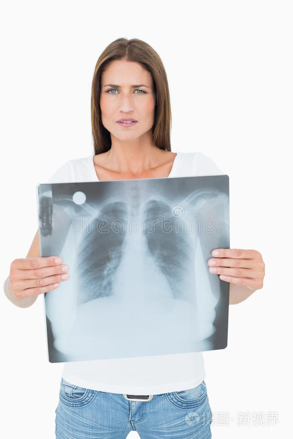 一位严肃的年轻女子手持肺部x光片的肖像