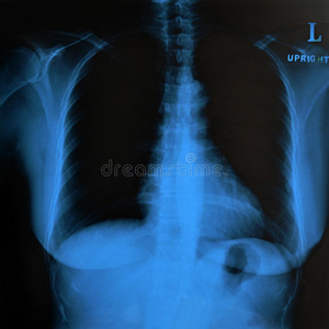 正常女性乳房的x线影像