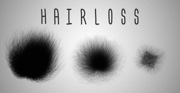 显示 hairloss 进度的发型集