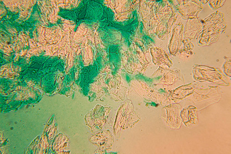 显微镜下人体细胞和干燥的彩色水
