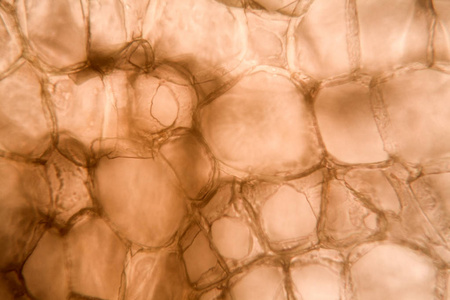 显微镜下的胡萝卜细胞