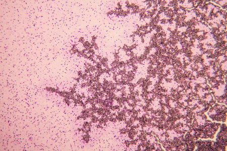 显微镜下的真菌图片