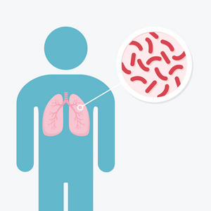 人肺疾病解剖学图。肺部感染的人。土