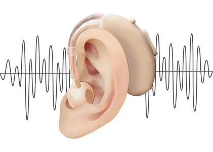 数字听觉辅助耳后, 在声波图的背景下。耳鼻咽喉听觉丧失的治疗和修复。现实的向量例证。医药卫生