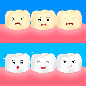 牙齿贴面美白可爱的卡通白和黄牙齿. 美白前后口腔护理理念.