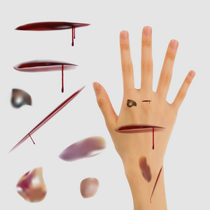 开放伤口图片-开放伤口素材-开放伤口插画-摄图新视界