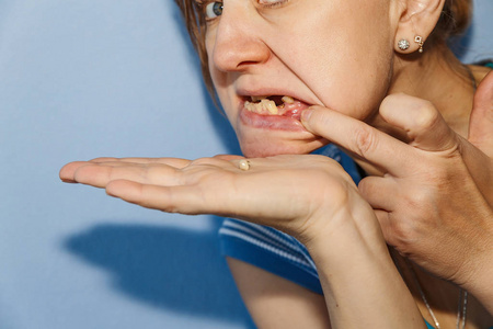 有缺陷的牙图片