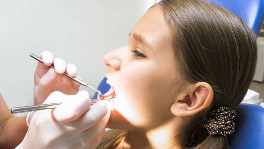 在牙医检查牙齿时, 少女张嘴的特写镜头图像照片