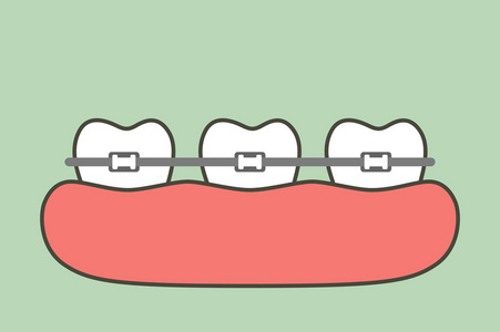 正畸牙齿或牙套牙齿卡通矢量平面造型可爱人物设计照片