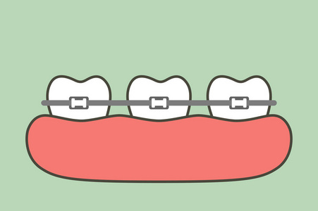 正畸牙齿或牙套牙齿卡通矢量平面造型可爱人物设计