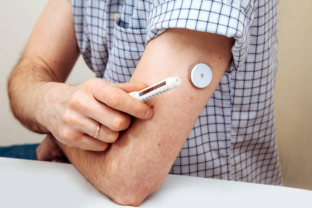 用数字血糖仪传感器检测葡萄糖水平的人检查没有血液的葡萄糖水平。 糖尿病治疗。