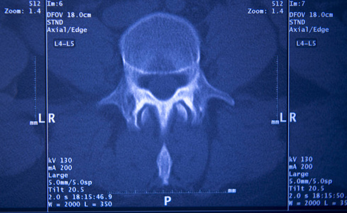 医疗医院x射线髋部脊柱骨盆MRI创伤扫描。