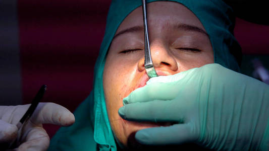 种植牙手术，切除牙胶手术，特写