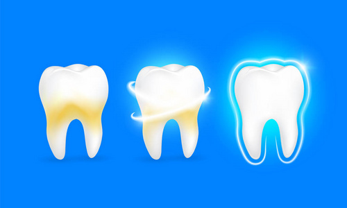 一套清洁和肮脏的牙齿在蓝色背景清除牙齿过程中。 牙齿美白。 牙科健康概念。 口腔护理牙齿修复。 黄色和白色的牙齿。