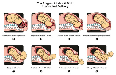 分娩阶段和出生在分娩信息图表，包括订婚血统内部完整旋转扩展海报的医学科学教育和医疗保健。