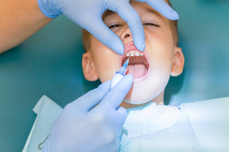 牙医在诊所检查男孩的牙齿。牙科椅上的一个小病人笑了。Dantist 治疗牙齿。牙医室的小男孩牙齿牙科治疗的特写图