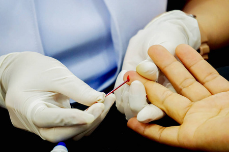 护士的特写双手戴橡胶白色医用手套,使用毛细管触摸并引流到人无名指