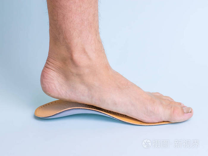 矫形鞋垫旁边有足病迹象的成年男性的左腿 治疗扁平足的手段 脚部疾病的照片 照片 正版商用图片12yvr8 摄图新视界 矫形鞋垫旁边有足病迹象的成年男性的左腿 治疗扁平足的手段 脚部疾病的照片 照片 正版商用图片12yvr8 摄图新视界