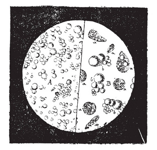 显微镜下看到的牛奶，老式雕刻插图。工业百科全书EO。拉米1875