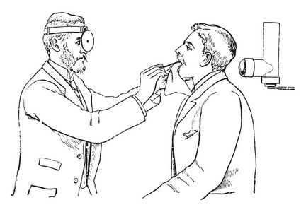 医生在喉镜仪器复古线绘图或雕刻插图的帮助下检查病人。