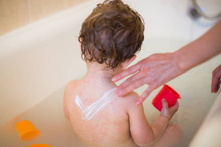 父母在室内洗澡时用医用凝胶清洗生病的儿子