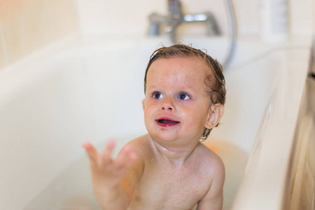 一个身体上有疹子的小男孩坐在浴室里，室内有水