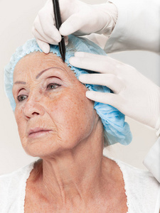 外科医生做皮肤检查上中旬年龄之前的整形手术的女人
